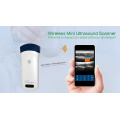 handheld wireless ultrasound for phone and pad